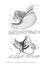 giornale/TO00193701/1946/unico/00000144