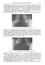 giornale/TO00193913/1910/unico/00000053