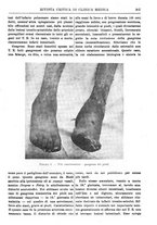 giornale/TO00193913/1919/unico/00000417