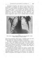 giornale/TO00194040/1933/unico/00000681