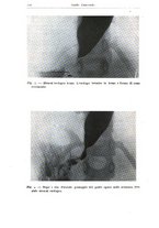 giornale/TO00194040/1942/unico/00000342