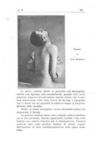 giornale/TO00194095/1917/unico/00000397