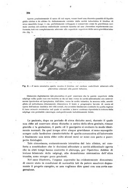 Rivista di ostetricia e ginecologia pratica organo della Societa siciliana di ostetricia e ginecologia