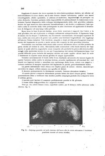 Rivista di ostetricia e ginecologia pratica organo della Societa siciliana di ostetricia e ginecologia