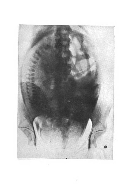 Rivista di ostetricia e ginecologia pratica organo della Societa siciliana di ostetricia e ginecologia