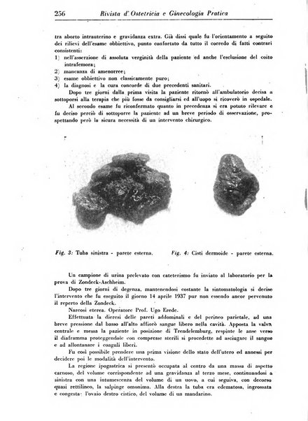 Rivista di ostetricia e ginecologia pratica organo della Societa siciliana di ostetricia e ginecologia