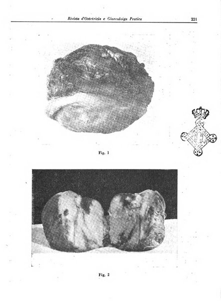 Rivista di ostetricia e ginecologia pratica organo della Societa siciliana di ostetricia e ginecologia