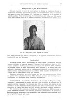 giornale/TO00194430/1925/unico/00000067