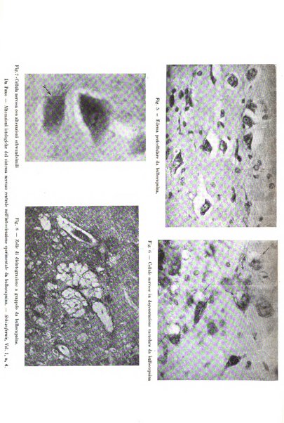 Schizofrenie bollettino trimestrale del primo Centro Provinciale di studio della demenza precoce