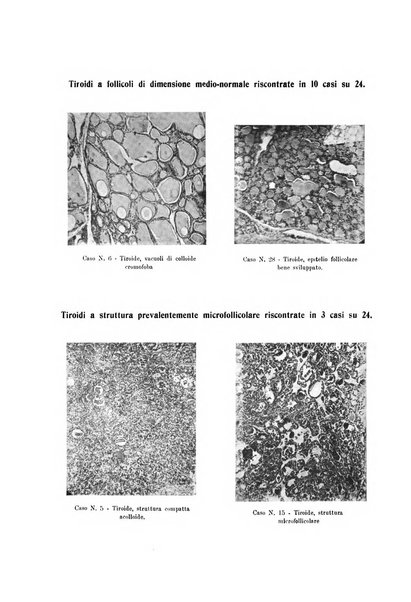 Schizofrenie bollettino trimestrale del primo Centro Provinciale di studio della demenza precoce