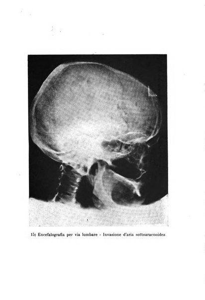 Schizofrenie bollettino trimestrale del primo Centro Provinciale di studio della demenza precoce