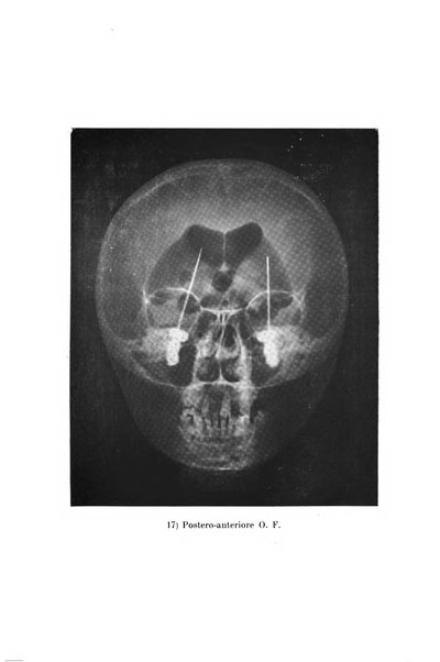 Schizofrenie bollettino trimestrale del primo Centro Provinciale di studio della demenza precoce