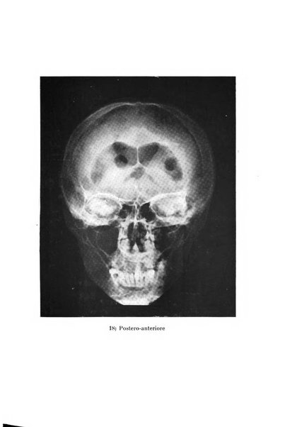 Schizofrenie bollettino trimestrale del primo Centro Provinciale di studio della demenza precoce