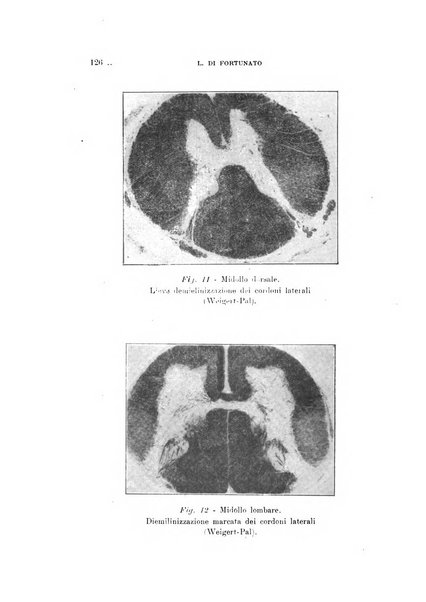 Schizofrenie bollettino trimestrale del primo Centro Provinciale di studio della demenza precoce