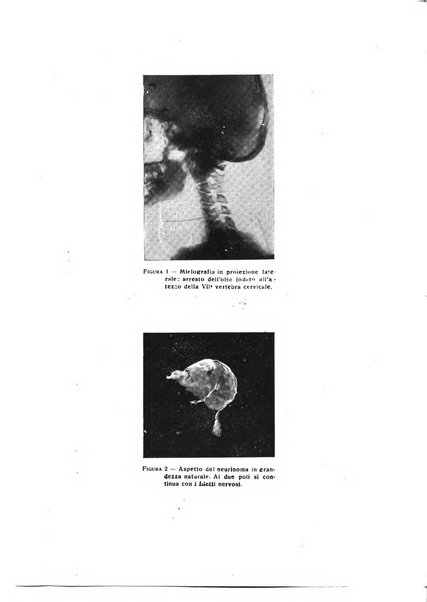 Schizofrenie bollettino trimestrale del primo Centro Provinciale di studio della demenza precoce