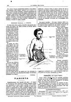 giornale/TO00194960/1879-1881/unico/00000222