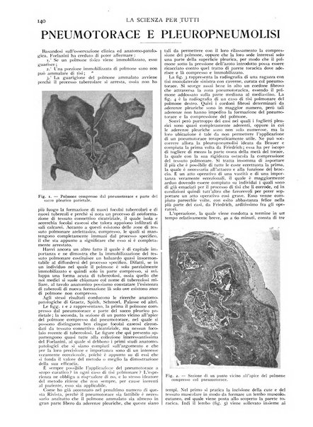 La scienza per tutti giornale popolare illustrato