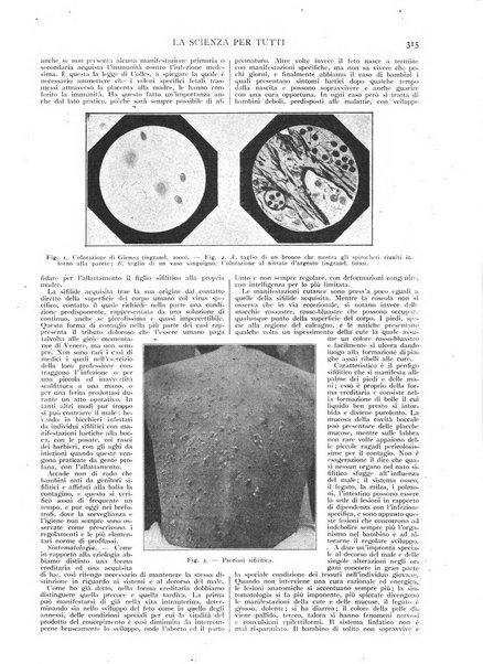 La scienza per tutti giornale popolare illustrato