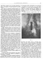 giornale/TO00195265/1944-1945/unico/00000081