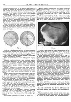 giornale/TO00195265/1944-1945/unico/00000186