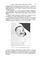 giornale/TO00195636/1899/unico/00000109