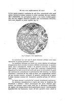 giornale/TO00195636/1921/v.75/00000021