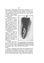 giornale/TO00195913/1912-1913/unico/00000481