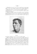 giornale/TO00195913/1913-1914/unico/00000451