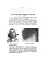 giornale/TO00195913/1918-1919/unico/00000068