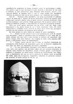 giornale/TO00195913/1923/unico/00000637