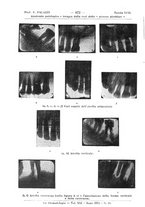 giornale/TO00195913/1923/unico/00000734