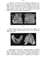 giornale/TO00195913/1935/unico/00000460