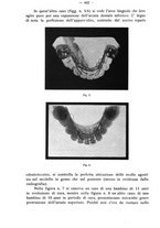 giornale/TO00195913/1935/unico/00000464