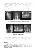 giornale/TO00195913/1938/unico/00000331