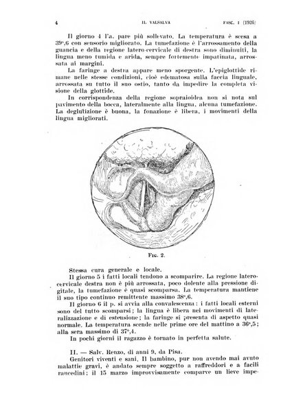 Il Valsalva rivista mensile di oto-rino-laringojatria