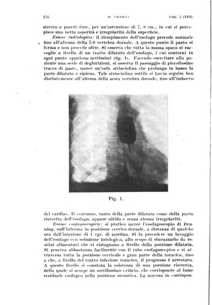 Il Valsalva rivista mensile di oto-rino-laringojatria