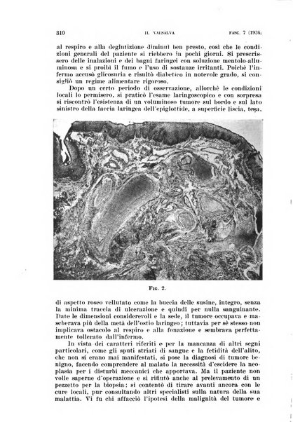 Il Valsalva rivista mensile di oto-rino-laringojatria