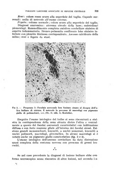 Il Valsalva rivista mensile di oto-rino-laringojatria