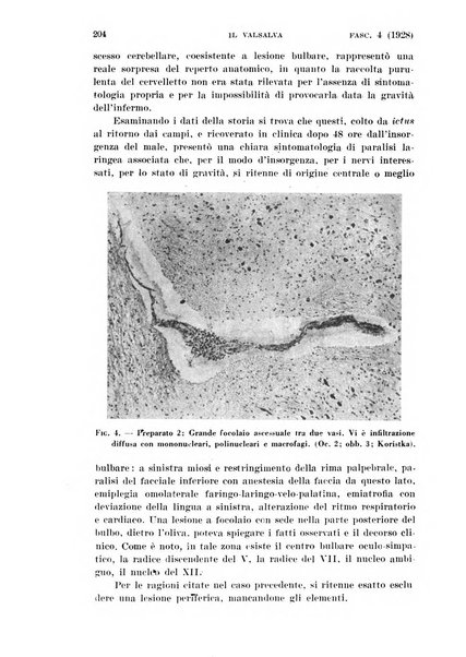 Il Valsalva rivista mensile di oto-rino-laringojatria