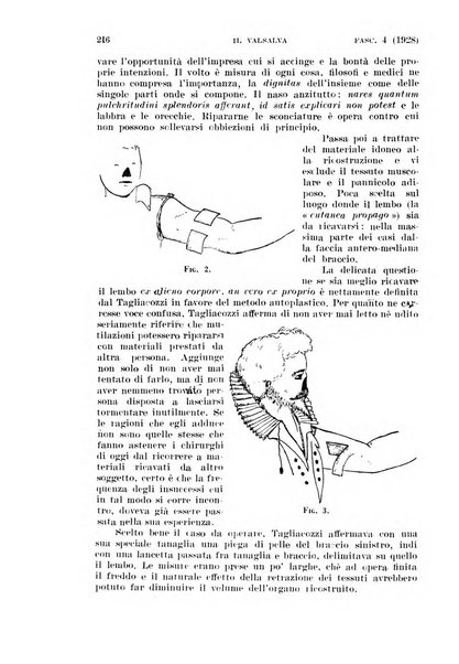 Il Valsalva rivista mensile di oto-rino-laringojatria