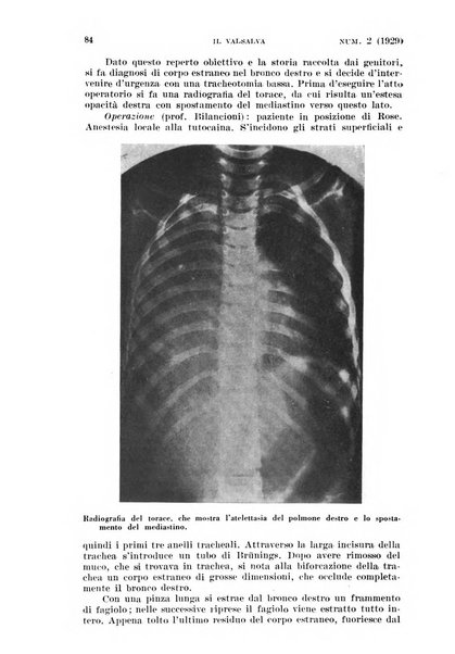 Il Valsalva rivista mensile di oto-rino-laringojatria