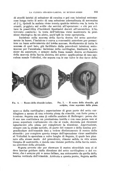 Il Valsalva rivista mensile di oto-rino-laringojatria