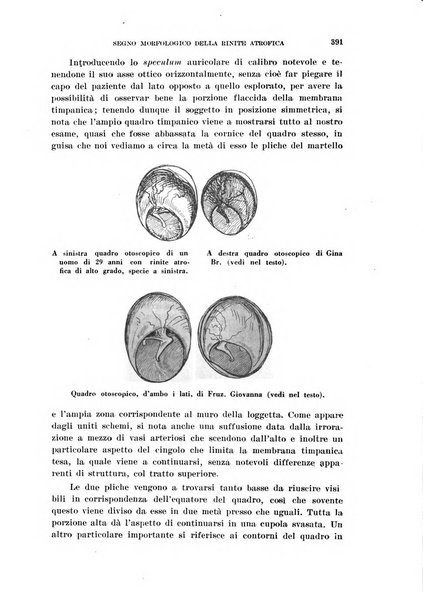 Il Valsalva rivista mensile di oto-rino-laringojatria