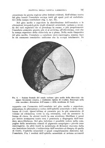 Il Valsalva rivista mensile di oto-rino-laringojatria