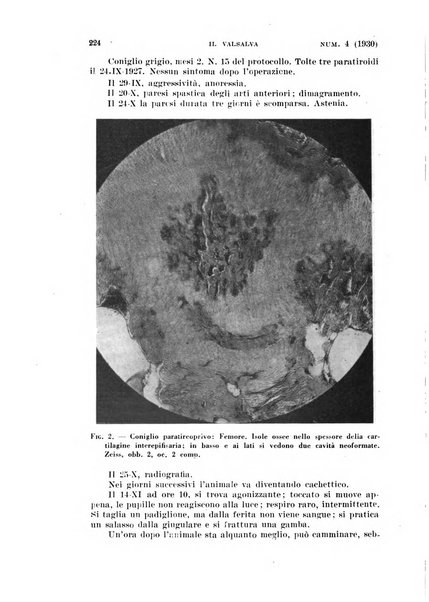 Il Valsalva rivista mensile di oto-rino-laringojatria