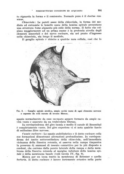 Il Valsalva rivista mensile di oto-rino-laringojatria