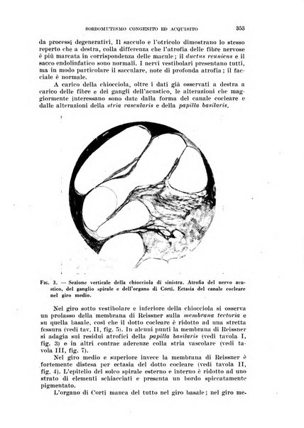 Il Valsalva rivista mensile di oto-rino-laringojatria