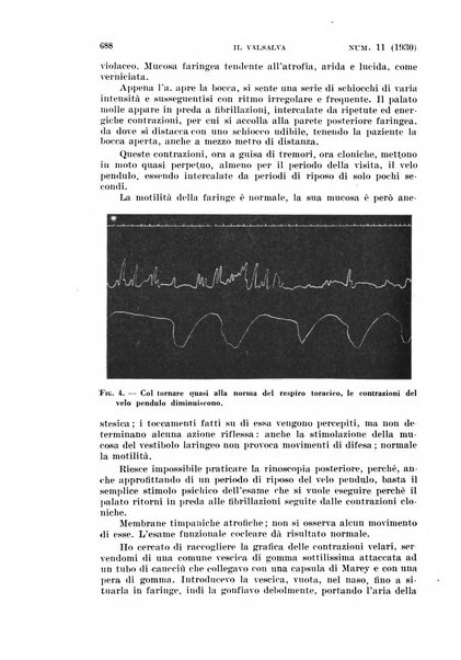 Il Valsalva rivista mensile di oto-rino-laringojatria