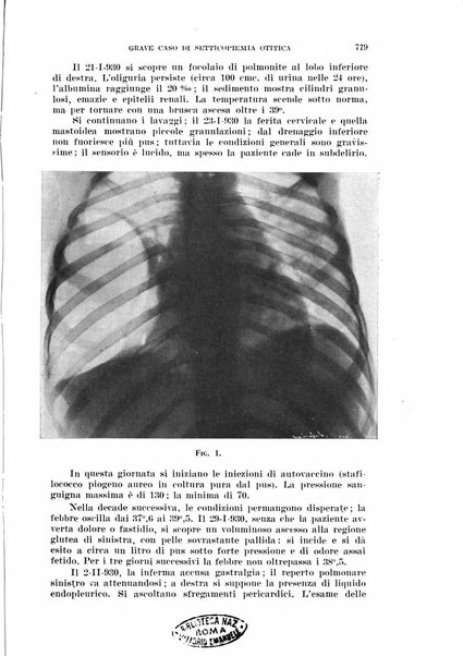 Il Valsalva rivista mensile di oto-rino-laringojatria