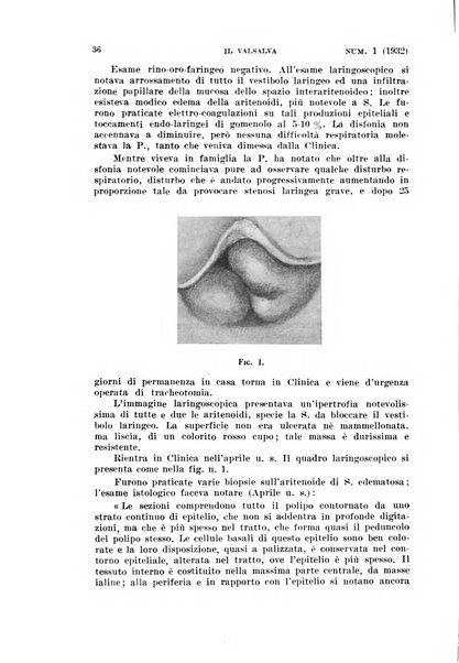 Il Valsalva rivista mensile di oto-rino-laringojatria